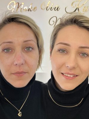 {"ARInfo":{"IsUseAR":false},"Version":"1.0.0","MakeupInfo":{"IsUseMakeup":false},"FaceliftInfo":{"IsChangeEyeLift":false,"IsChangeFacelift":false,"IsChangePostureLift":false,"IsChangeNose":false,"IsChangeFaceChin":false,"IsChangeMouth":false,"IsChangeThinFace":false},"BeautyInfo":{"SwitchMedicatedAcne":false,"IsAIBeauty":false,"IsBrightEyes":false,"IsSharpen":false,"IsOldBeauty":false,"IsReduceBlackEyes":false},"HandlerInfo":{"AppName":2},"FilterInfo":{"IsUseFilter":false}}